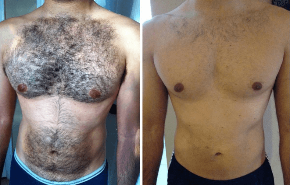 Męska depilacja – wymysł czy wymóg?
